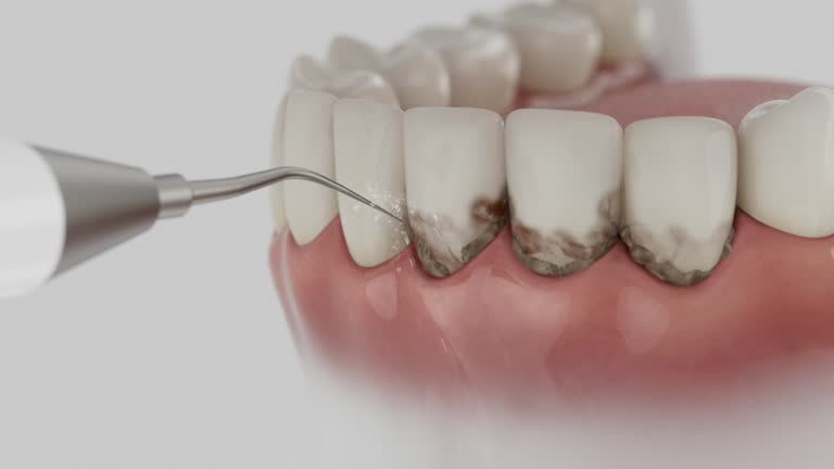 Reliable Wisdom Tooth Removal contractor in Roane County County, TN by Dentist Open Now